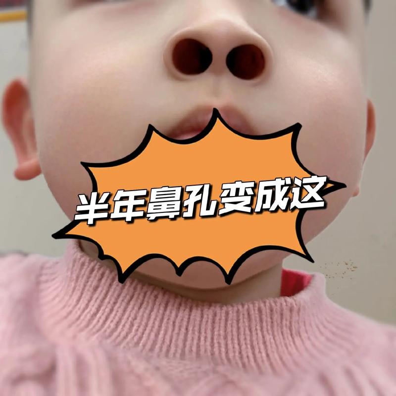 挖鼻孔满脸肿胀变形,挖鼻孔满脸肿胀变形怎么办